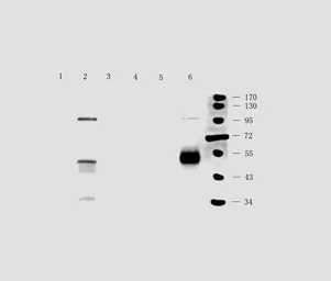 Anti-Semaphorin 3A antibody used in Western Blot (WB). GTX37550