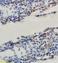 Anti-Osteopontin antibody used in IHC (Paraffin sections) (IHC-P). GTX37582