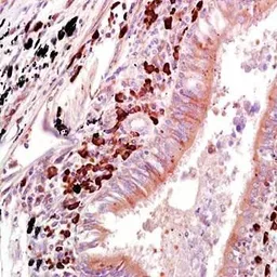 Anti-OAS1 antibody used in IHC (Paraffin sections) (IHC-P). GTX37589