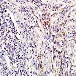 Anti-Lipocalin-2 antibody used in IHC (Paraffin sections) (IHC-P). GTX37600