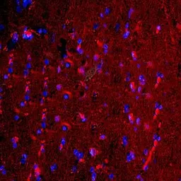 Anti-Lipocalin-2 antibody used in IHC (Paraffin sections) (IHC-P). GTX37600