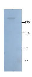 Anti-Nestin antibody used in Western Blot (WB). GTX37606