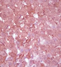 Anti-MRP3 antibody used in IHC (Paraffin sections) (IHC-P). GTX37616