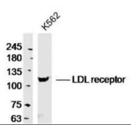 Anti-LDL Receptor antibody used in Western Blot (WB). GTX37639
