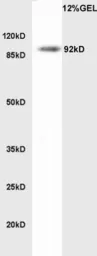 Anti-LDL Receptor antibody used in Western Blot (WB). GTX37639