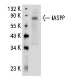 Anti-IASPP antibody used in Western Blot (WB). GTX37659
