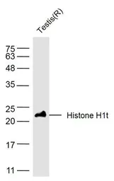 Anti-Histone H1t antibody used in Western Blot (WB). GTX37669