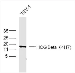 Anti-hCG beta antibody [4H7] used in Western Blot (WB). GTX37674