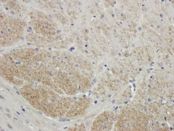 Anti-Filaggrin antibody used in IHC (Paraffin sections) (IHC-P). GTX37695
