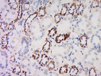 Anti-beta 2 Defensin antibody used in IHC (Paraffin sections) (IHC-P). GTX37716