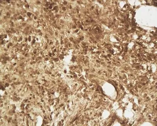 Anti-beta 2 Defensin antibody used in IHC (Paraffin sections) (IHC-P). GTX37716