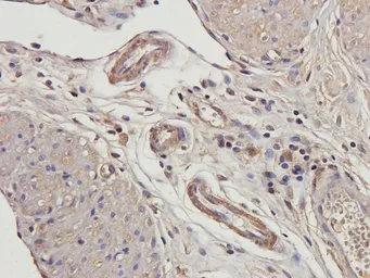 Anti-beta 2 Defensin antibody used in IHC (Paraffin sections) (IHC-P). GTX37717
