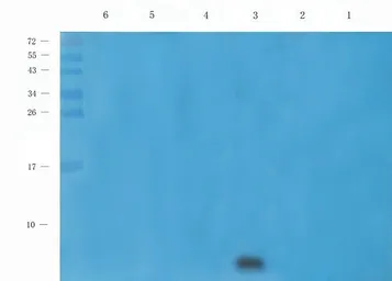 Anti-beta 2 Defensin antibody used in Western Blot (WB). GTX37717