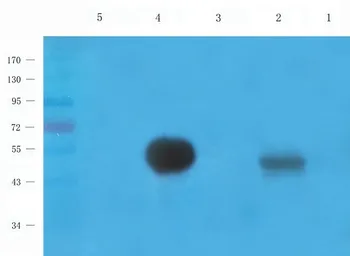 Anti-Connexin 40 antibody used in Western Blot (WB). GTX37725