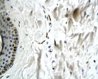 Anti-Collagen VII antibody used in IHC (Paraffin sections) (IHC-P). GTX37733
