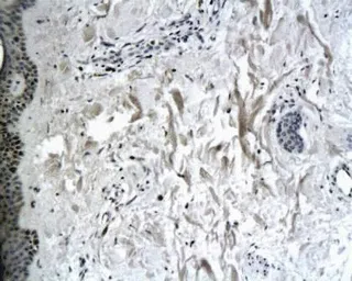 Anti-Collagen VII antibody used in IHC (Paraffin sections) (IHC-P). GTX37733