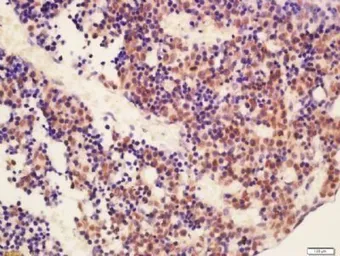 Anti-RUNX2 antibody used in IHC (Paraffin sections) (IHC-P). GTX37759