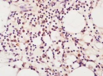 Anti-RUNX2 antibody used in IHC (Paraffin sections) (IHC-P). GTX37759