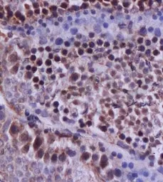 Anti-Caspase 12 antibody used in IHC (Paraffin sections) (IHC-P). GTX37762