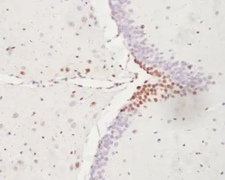 Anti-ATF3 antibody used in IHC (Paraffin sections) (IHC-P). GTX37776