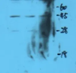 Anti-ATF3 antibody used in Western Blot (WB). GTX37776
