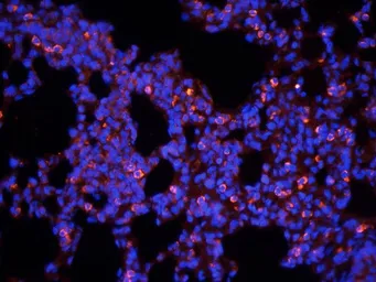 Anti-Aquaporin 9 antibody used in IHC (Frozen sections) (IHC-Fr). GTX37783
