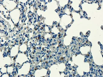 Anti-Aquaporin 9 antibody used in IHC (Paraffin sections) (IHC-P). GTX37783