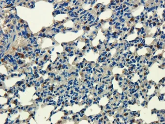 Anti-Aquaporin 9 antibody used in IHC (Paraffin sections) (IHC-P). GTX37783