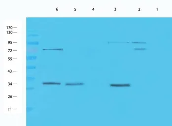 Anti-Aquaporin 9 antibody used in Western Blot (WB). GTX37783