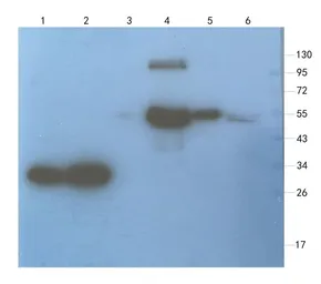 Anti-Aquaporin 4 antibody used in Western Blot (WB). GTX37784