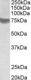 Anti-TRC8 antibody, C-term used in Western Blot (WB). GTX38010
