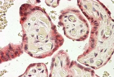 Anti-TRC8 antibody, C-term used in IHC (Paraffin sections) (IHC-P). GTX38010