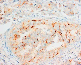 Anti-OPCML antibody used in IHC (Paraffin sections) (IHC-P). GTX38534