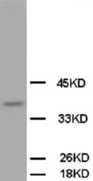Anti-OPCML antibody used in Western Blot (WB). GTX38534