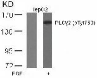 Anti-PLCG2 (phospho Tyr753) antibody used in Western Blot (WB). GTX38559