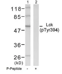 Anti-Lck (phospho Tyr394) antibody used in Western Blot (WB). GTX38561