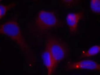 Anti-ZAP70 (phospho Tyr319) antibody used in Immunocytochemistry/ Immunofluorescence (ICC/IF). GTX38562