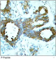 Anti-PAK1 ( phospho Thr423 ) / PAK2 ( phospho Thr402 ) / PAK3 ( phospho Thr436 ) antibody used in IHC (Paraffin sections) (IHC-P). GTX38587