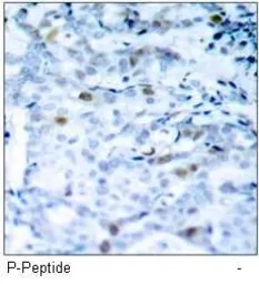 Anti-CDC2 (phospho Thr161) antibody used in IHC (Paraffin sections) (IHC-P). GTX38597