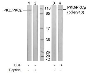 Anti-PKC mu (phospho Ser910) antibody used in Western Blot (WB). GTX38601
