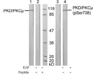 Anti-PKC mu (phospho Ser738) antibody used in Western Blot (WB). GTX38607