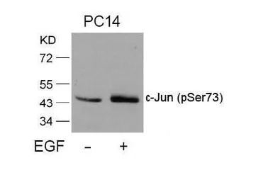 Anti-c-Jun (phospho Ser73) antibody used in Western Blot (WB). GTX38608