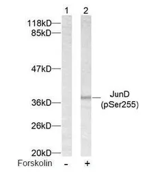 Anti-JunD (phospho Ser255) antibody used in Western Blot (WB). GTX38656