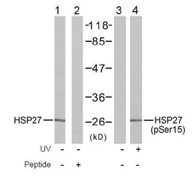 Anti-HSP27 (phospho Ser15) antibody used in Western Blot (WB). GTX38674