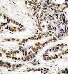Anti-CREB (phospho Ser129) antibody used in IHC (Paraffin sections) (IHC-P). GTX38681