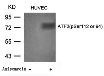 Anti-ATF2 (phospho Ser112) antibody used in Western Blot (WB). GTX38683