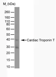 Anti-Cardiac Troponin T antibody [TT44 (BGN/1288/44)] used in Western Blot (WB). GTX38867