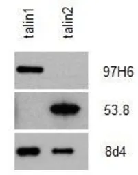 Anti-Talin-2 antibody [53.8] used in Western Blot (WB). GTX38971