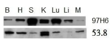Anti-Talin-2 antibody [53.8] used in Western Blot (WB). GTX38971