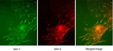 Anti-Talin-1 antibody [97H6] used in Immunocytochemistry/ Immunofluorescence (ICC/IF). GTX38973